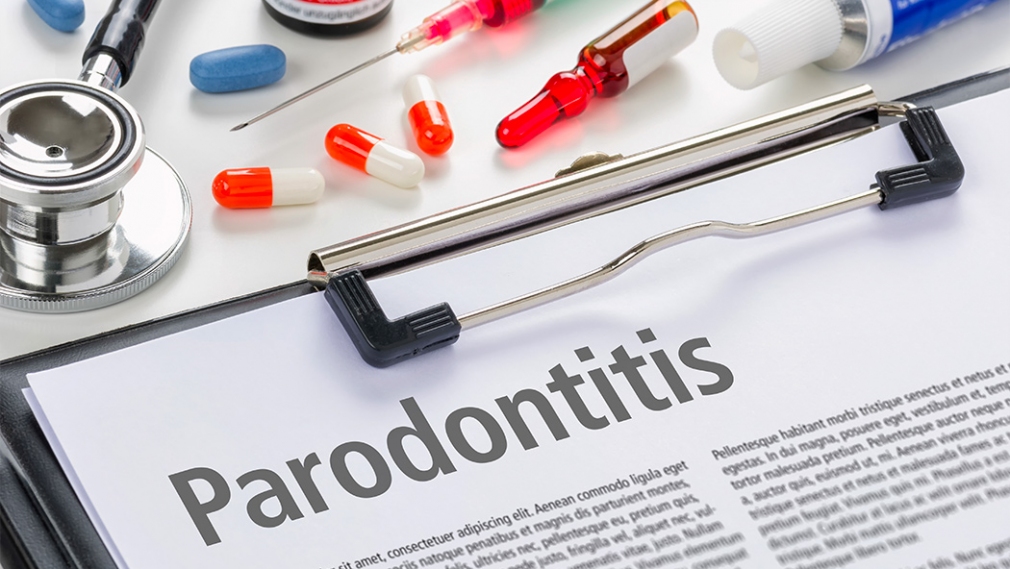 odha-newswire-Treatment of periodontitis and C-reactive protein.jpg