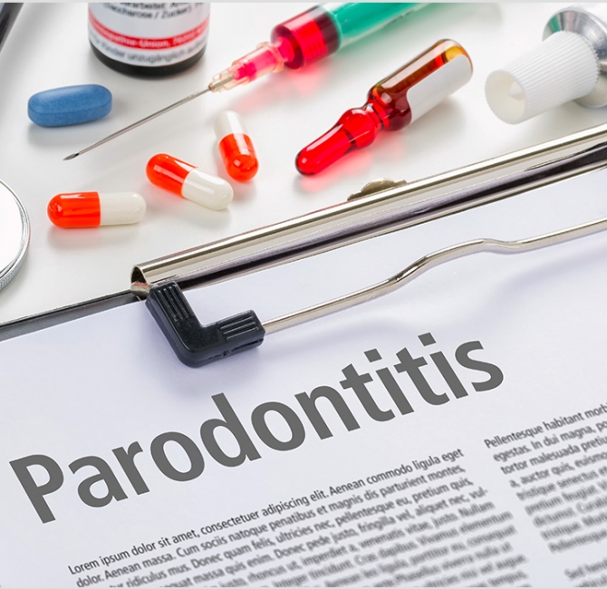 odha-newswire-Treatment of periodontitis and C-reactive protein.jpg
