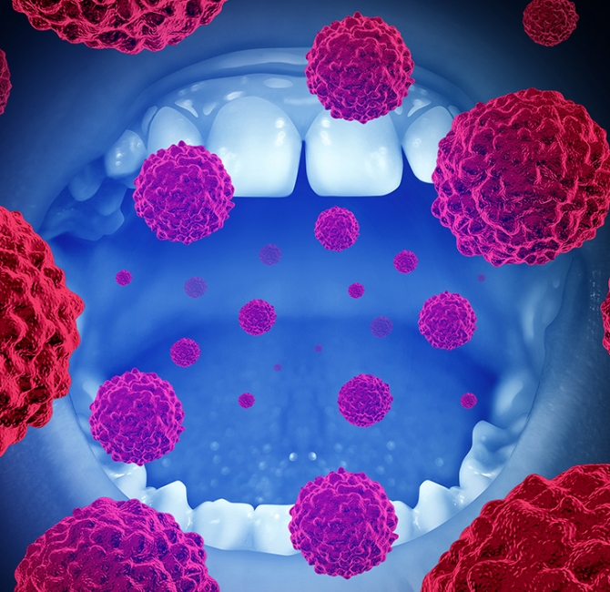 Rise in oral cancer risk factors associated with the COVID