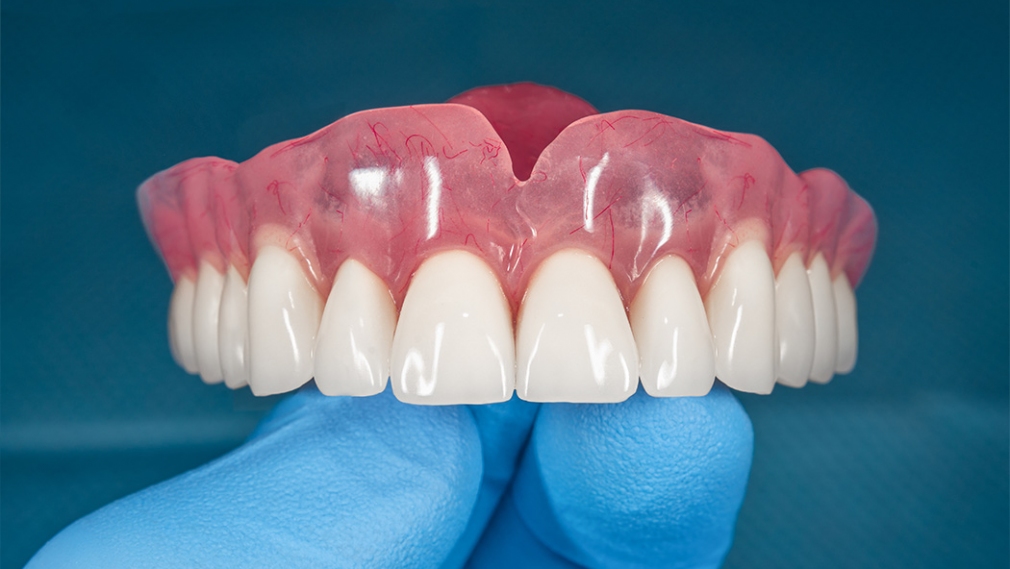 Denture stomatitis – An interdisciplinary clinical review