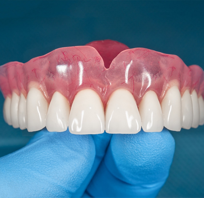 Denture stomatitis – An interdisciplinary clinical review