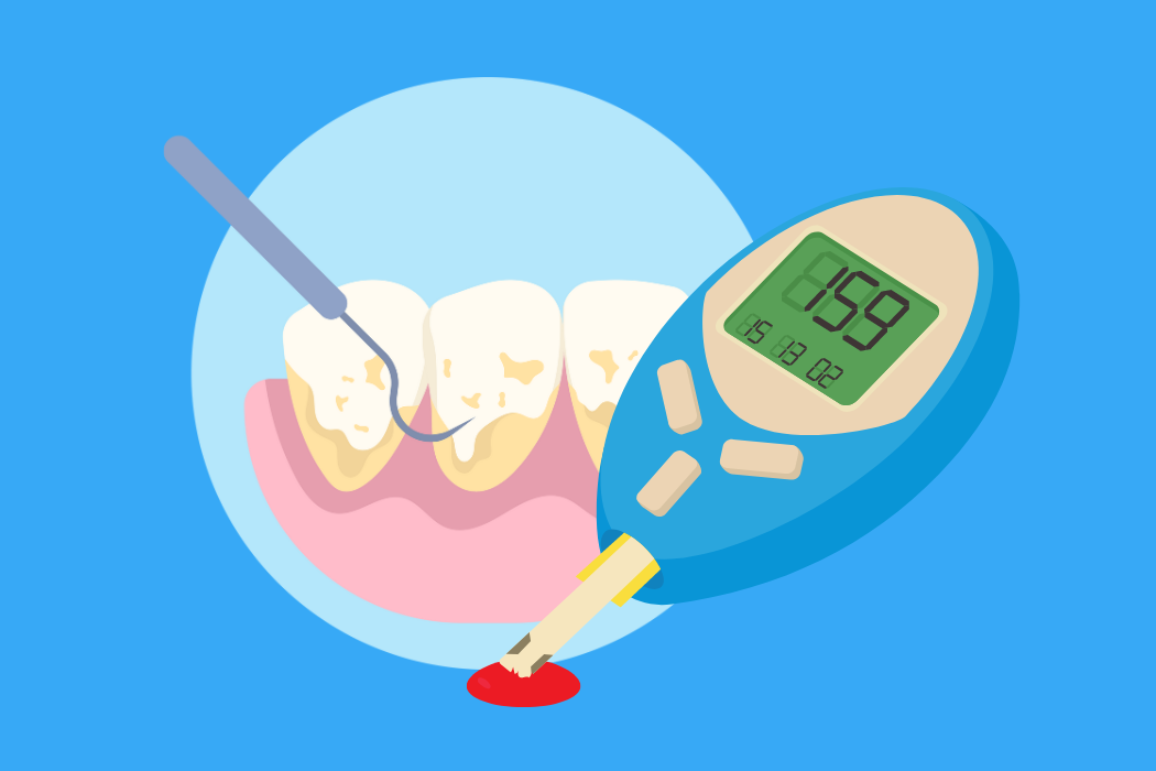 Periodontitis treatment for glycemic control in people with diabetes