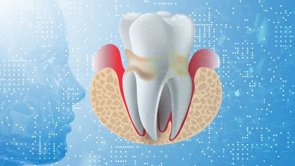 Artificial intelligence in classification of periodontal diseases