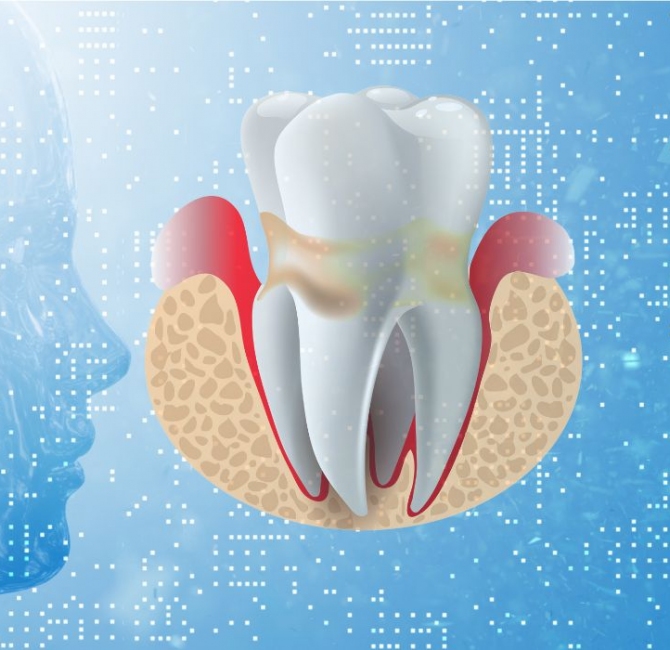 Artificial intelligence in classification of periodontal diseases