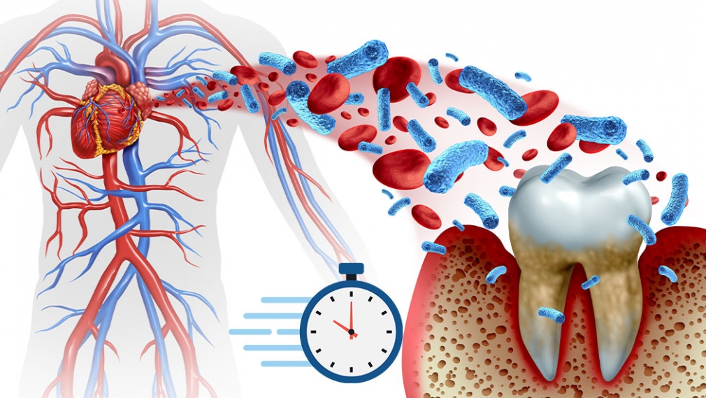 Biological aging mediates the association between periodontitis and cardiovascular disease: Results from a national population study and Mendelian randomization analysis