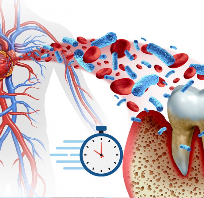 Biological aging mediates the association between periodontitis and cardiovascular disease: Results from a national population study and Mendelian randomization analysis