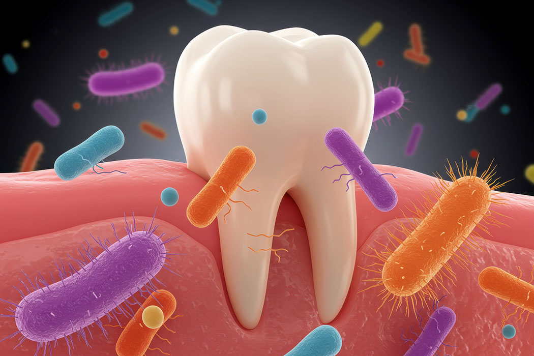 Dental-plaque-community.