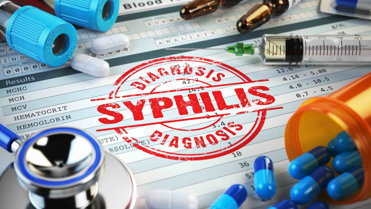 Oral syphilis - the great imitator: a series of six cases