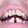 Stage IV periodontitis clinical practice guideline